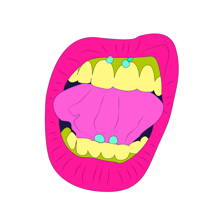 Piercing en la lengua: perforación en la punta de la lengua.