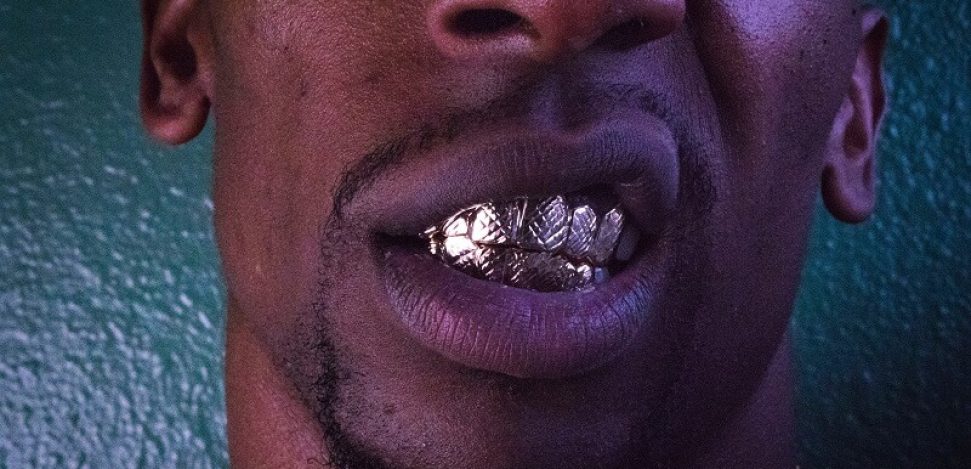 Qué son los grillz en los dientes.